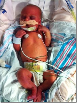 babysarge